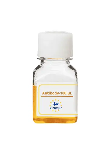 [DF2584] ALKBH4 Antibody   