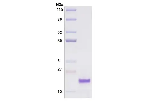 [MC11-050] Recombinant Human Siglec-8, His Tag -50 ug